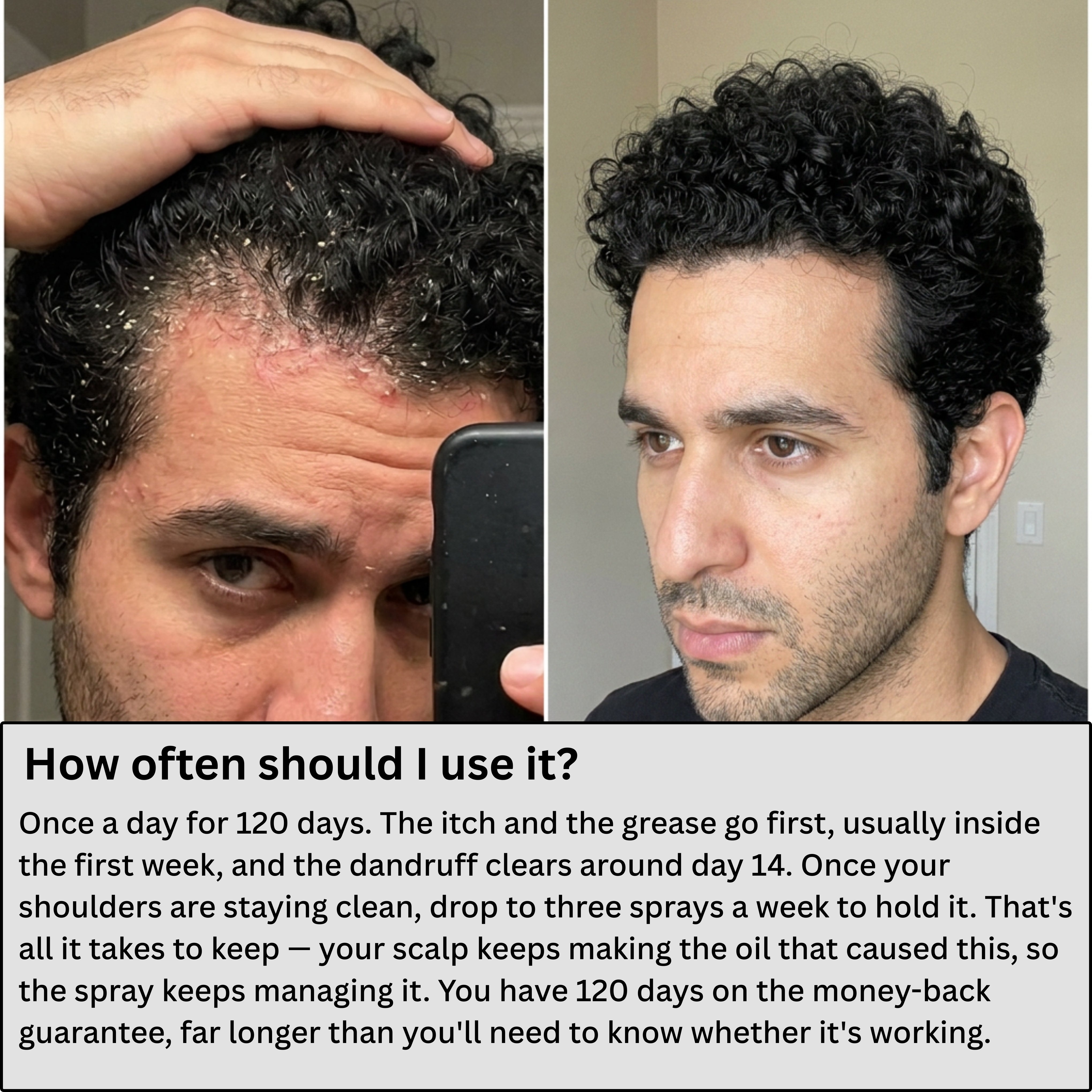 AlphaVance™ Ultimate Scalp Recovery Spray