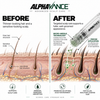 Alphavance — Scalp care technology — English