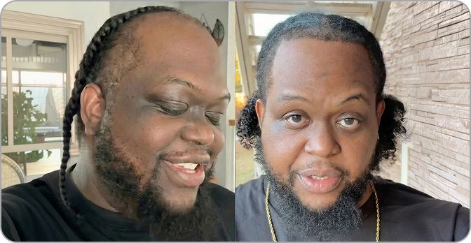AlphaVance customer result
